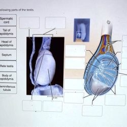 Correctly label the following parts of the testis.